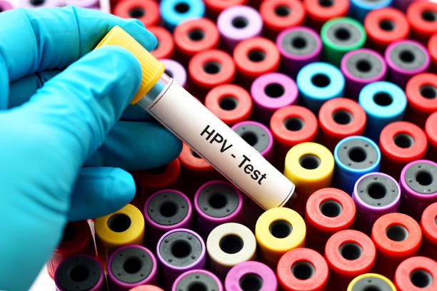 HPV: Unmasking the Secretive Virus That Affects Millions